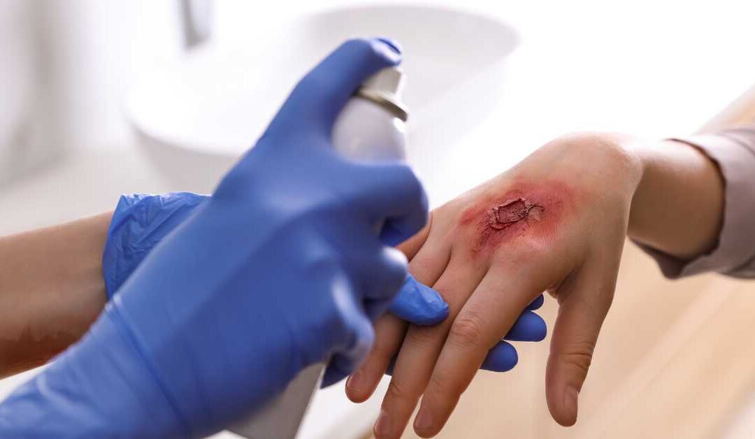 How to Avoid Fire and Burn Injuries This Halloween