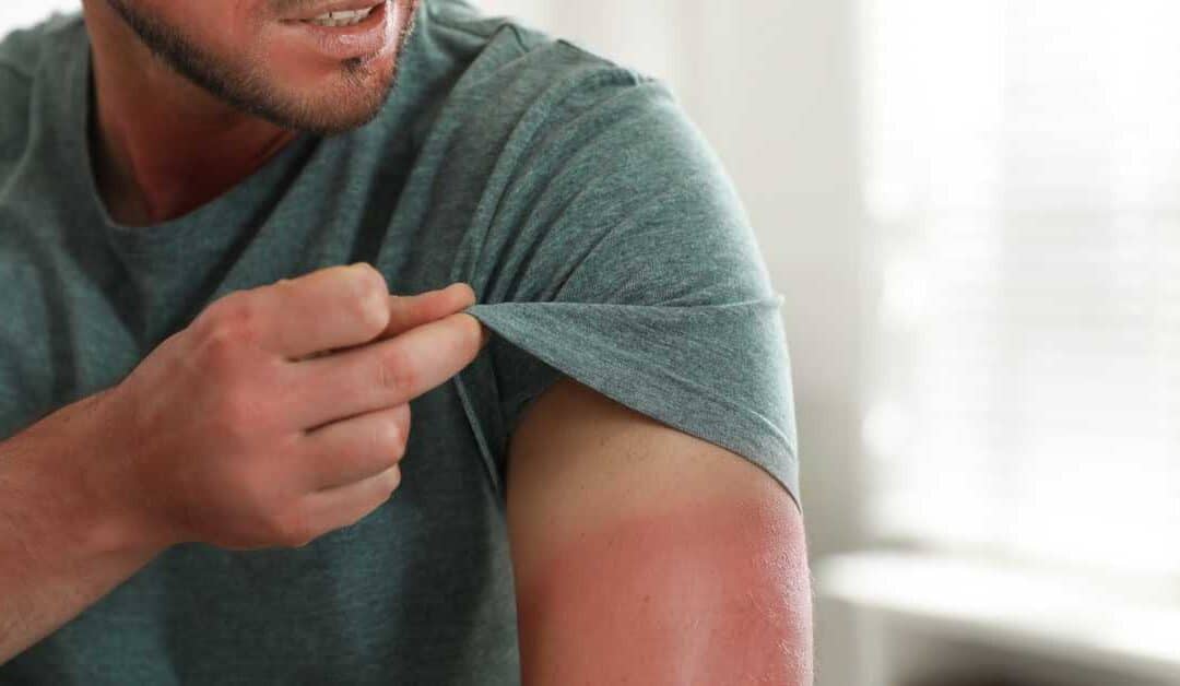 Indianapolis Fire and Burn Injury Lawyers Discuss Fourth of July Safety